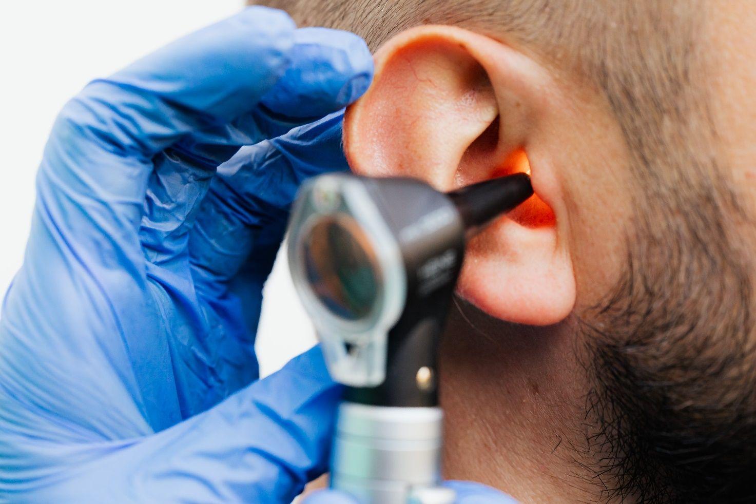 Nahaufnahme vom Ohr eines Mannes, der im Zuge einer Tinnitus-Behandlung mit einem Otoskop untersucht wird.